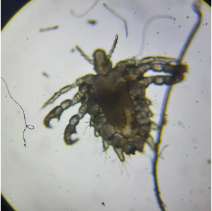 phthirus pubis_1.png